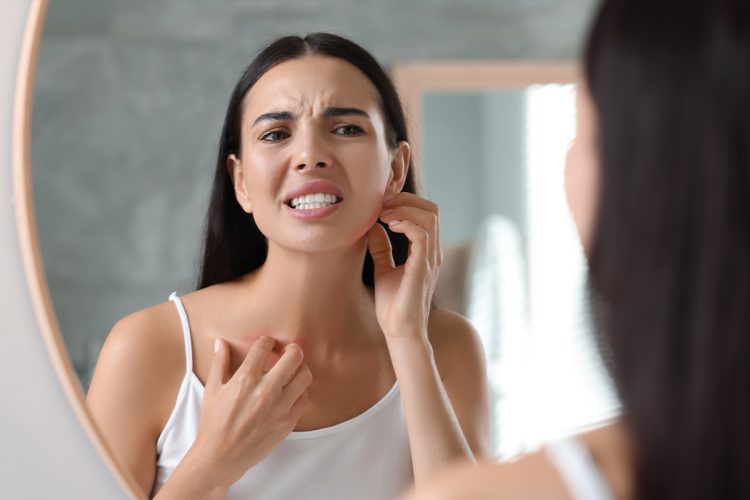 Cómo adaptar tu rutina de maquillaje a las alergias cutáneas