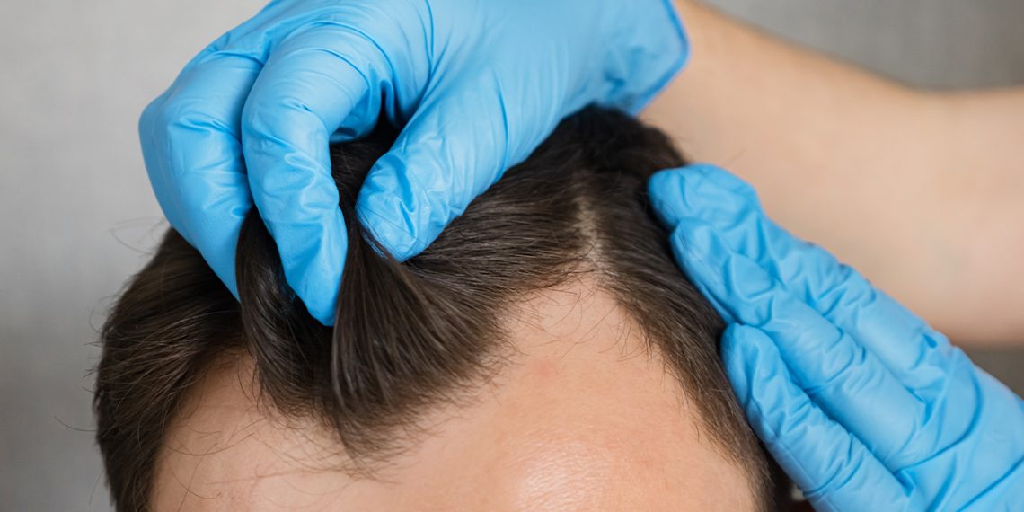 Permanente de pelo para hombres: técnicas y estilos