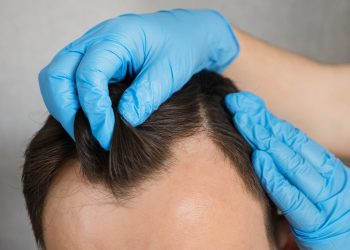 Permanente de pelo para hombres: técnicas y estilos