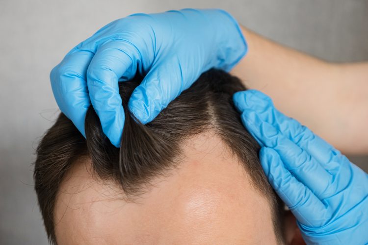 Permanente de pelo para hombres: técnicas y estilos