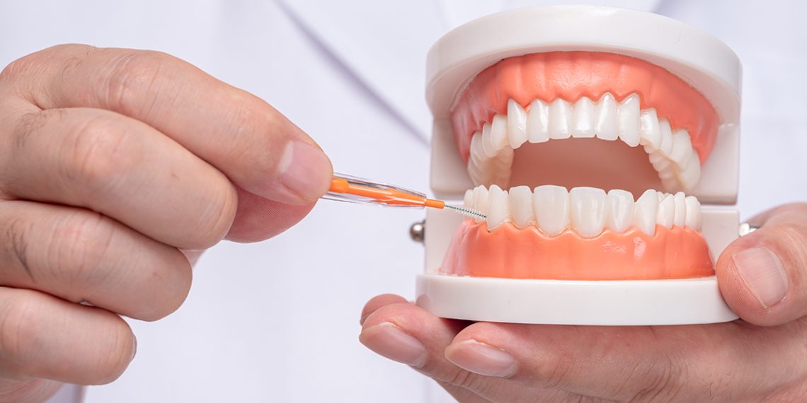 La mejor alternativa al hilo dental depende de tus necesidades específicas