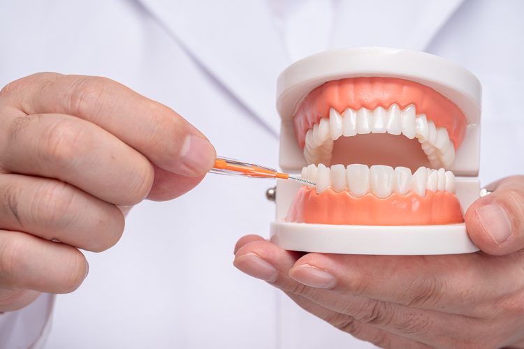 La mejor alternativa al hilo dental depende de tus necesidades específicas