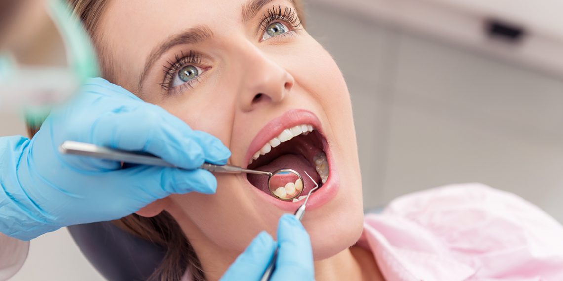 Caries: cómo se forman y cómo prevenirlas