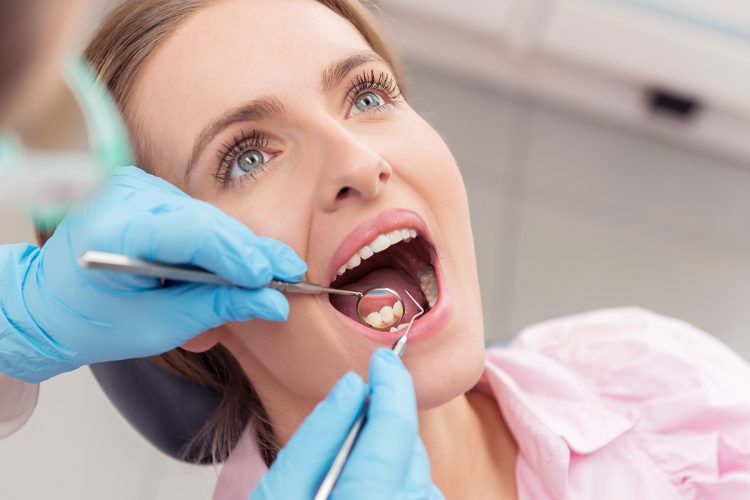 Caries: cómo se forman y cómo prevenirlas