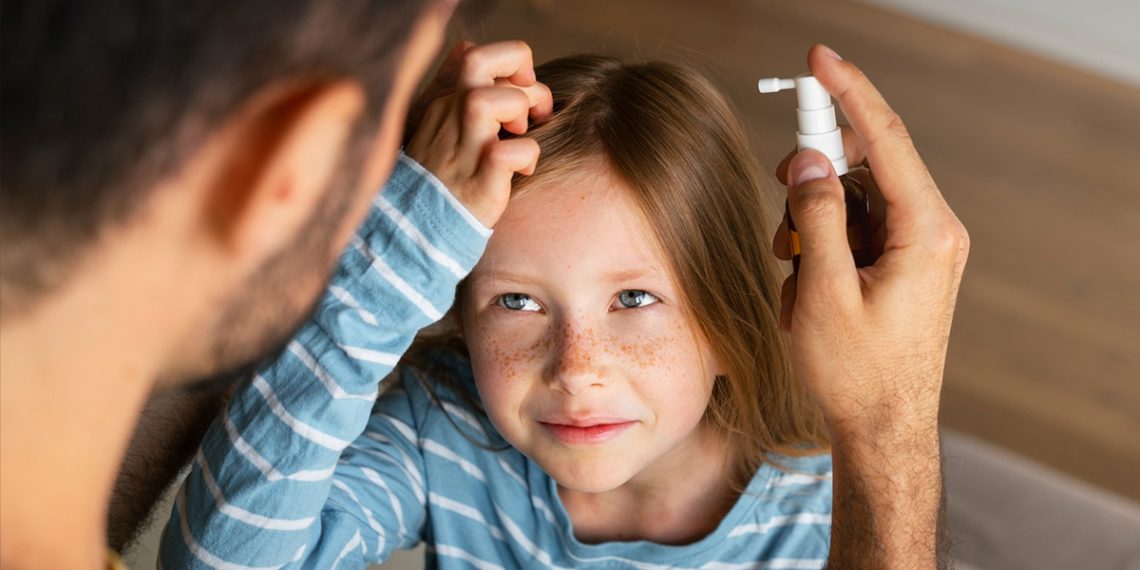 Productos para quitar piojos y liendres