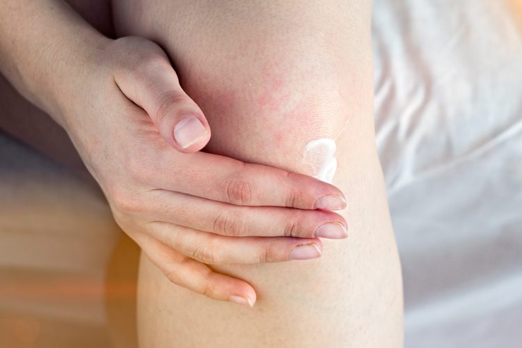 Psoriasis en las rodillas: tratamientos