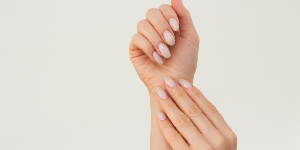 Psoriasis en las uñas: cómo tratarla