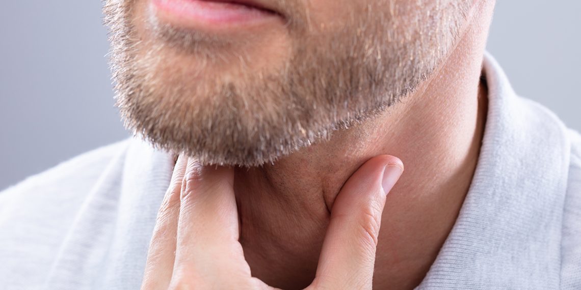 Dermatitis seborreica en la barba: tratamientos