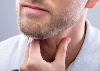 Dermatitis seborreica en la barba: tratamientos