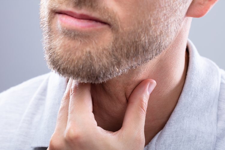 Dermatitis seborreica en la barba: tratamientos